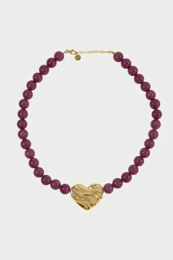 Rue Des Mille Narukvice 